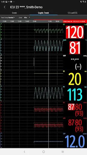 Mindray Mobile Viewer डाउनलोड करें – रीयल-टाइम पेशेंट मॉनिटरिंग - Screenshot 23